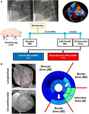Mitral regurgitation increases systolic strains in remote zone and worsens left ventricular dyssynchrony in a swine model of ischemic cardiomyopathy
